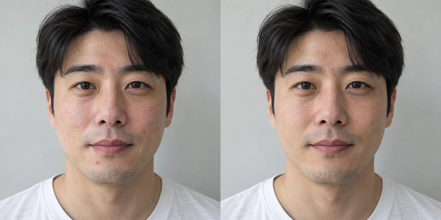 피부과: 이전 / 이후